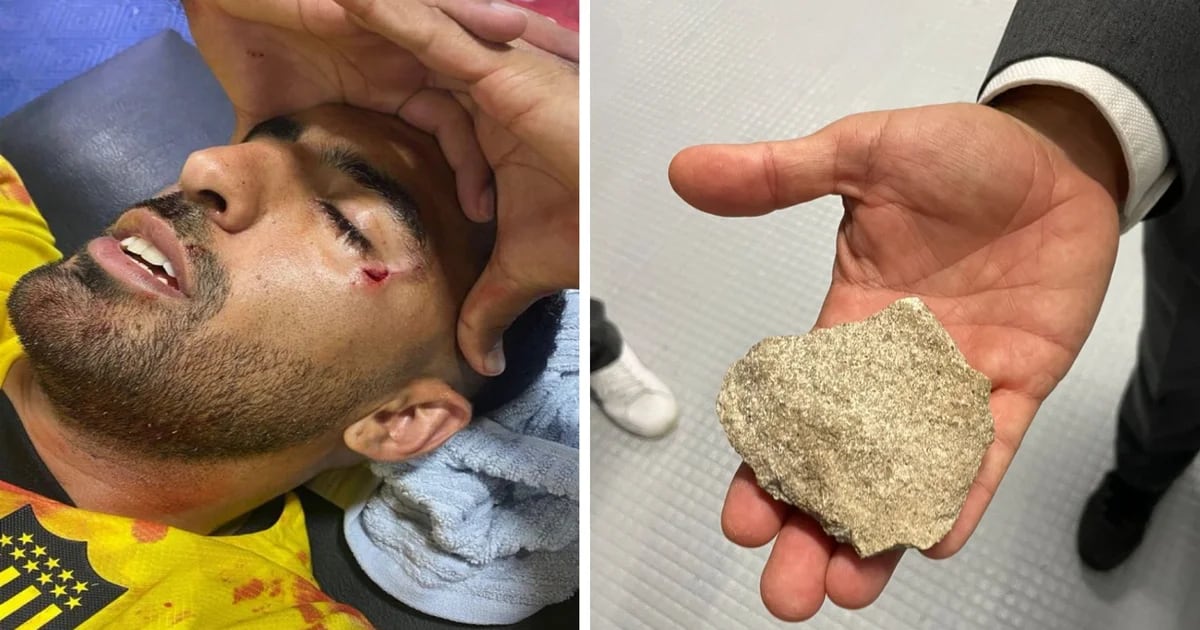 El duro descargo del jugador de Peñarol Maxi Olivera agredido con un proyectil en su rostro ante Rosario Central: “¡Una vergüenza!”