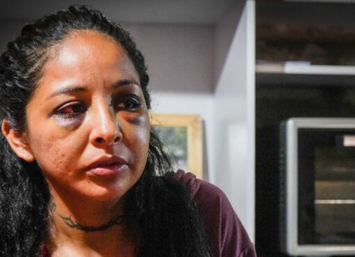 Sin botón antipánico, sin ventanas y con sus hermanos que la cuidan por turno: así vive Verónica, la sanjuanina que sobrevivió a la brutal paliza de su pareja