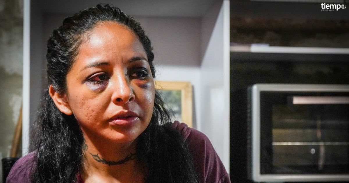 Sin botón antipánico, sin ventanas y con sus hermanos que la cuidan por turno: así vive Verónica, la sanjuanina que sobrevivió a la brutal paliza de su pareja