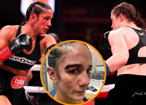 Cabezazos, cortes y un fallo polémico: así fue la sangrienta pelea entre Katie Taylor y Amanda Serrano previo al combate Tyson-Paul