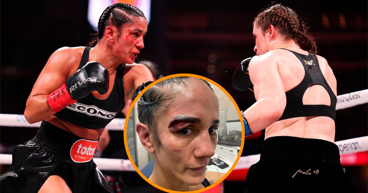 Cabezazos, cortes y un fallo polémico: así fue la sangrienta pelea entre Katie Taylor y Amanda Serrano previo al combate Tyson-Paul