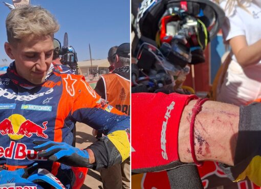 Heridas, calambres y desgaste mental: la dureza extrema de la etapa 1 del Rally Dakar